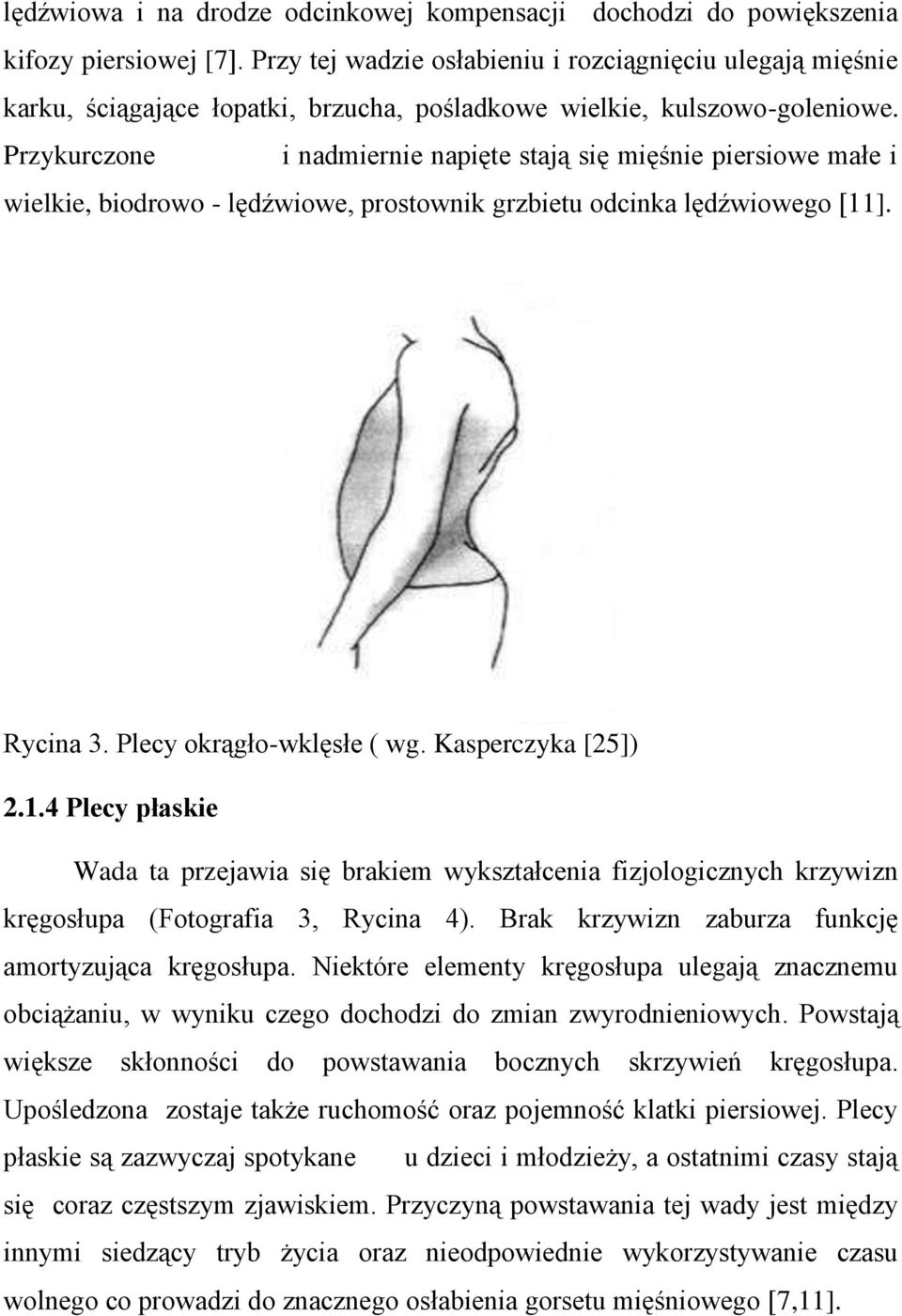 Przykurczone i nadmiernie napięte stają się mięśnie piersiowe małe i wielkie, biodrowo - lędźwiowe, prostownik grzbietu odcinka lędźwiowego [11]. Rycina 3. Plecy okrągło-wklęsłe ( wg.