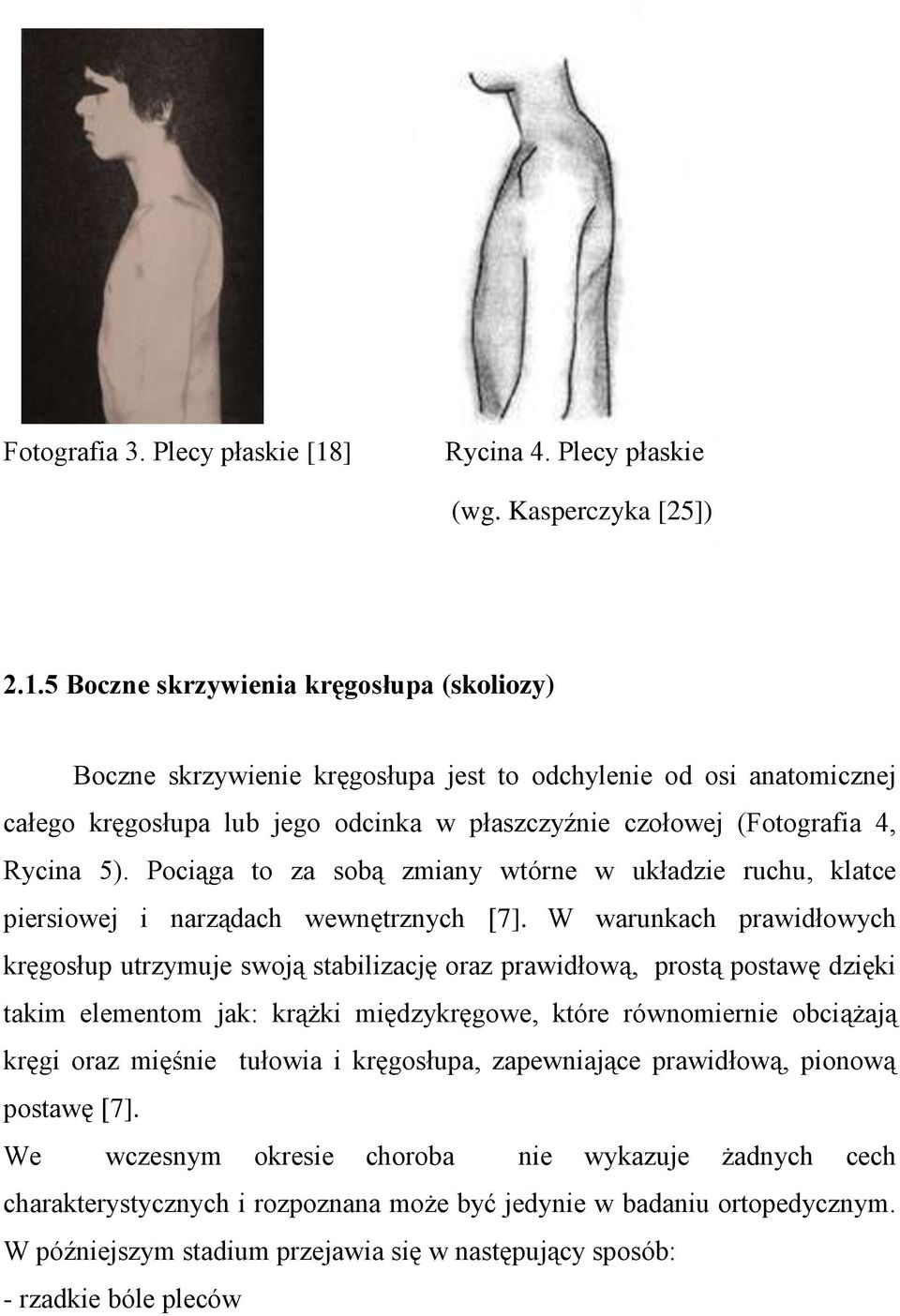 5 Boczne skrzywienia kręgosłupa (skoliozy) Boczne skrzywienie kręgosłupa jest to odchylenie od osi anatomicznej całego kręgosłupa lub jego odcinka w płaszczyźnie czołowej (Fotografia 4, Rycina 5).