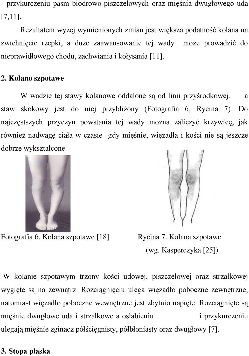 Kolano szpotawe W wadzie tej stawy kolanowe oddalone są od linii przyśrodkowej, a staw skokowy jest do niej przybliżony (Fotografia 6, Rycina 7).