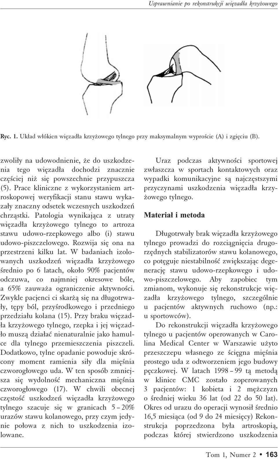 Prace kliniczne z wykorzystaniem artroskopowej weryfikacji stanu stawu wykazaæy znaczny odsetek wczesnych uszkodzeñ chrzåstki.