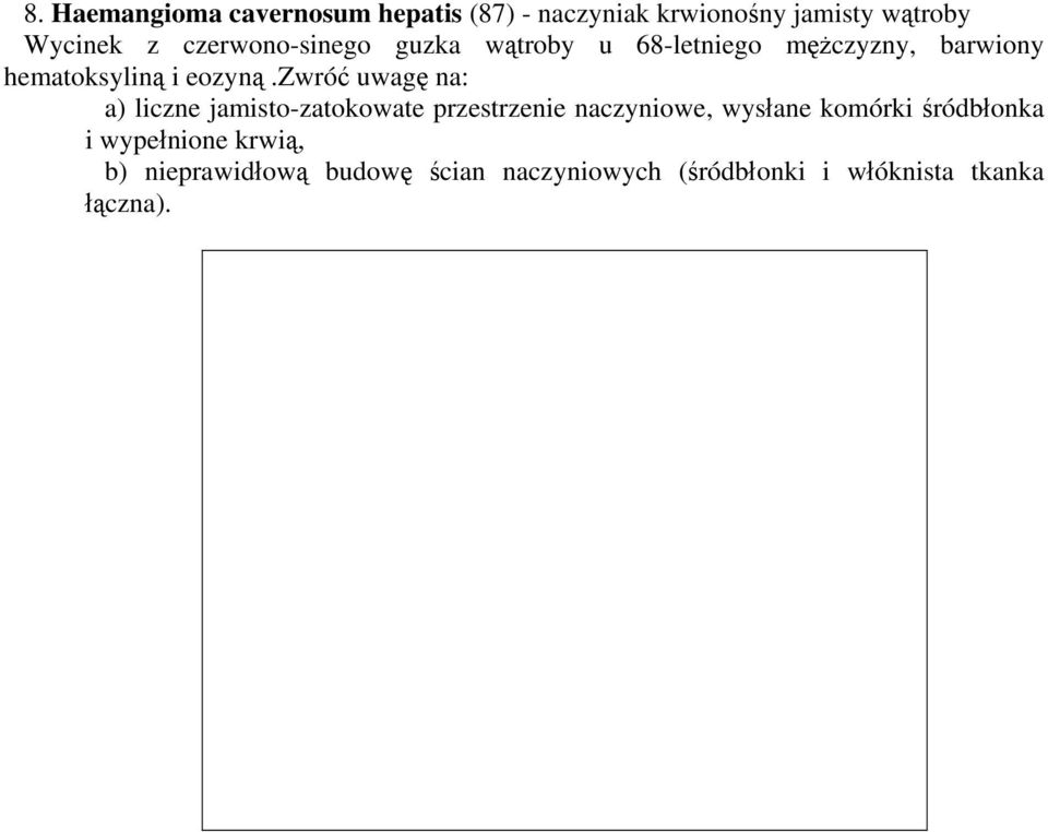 zwróć uwagę na: a) liczne jamisto-zatokowate przestrzenie naczyniowe, wysłane komórki