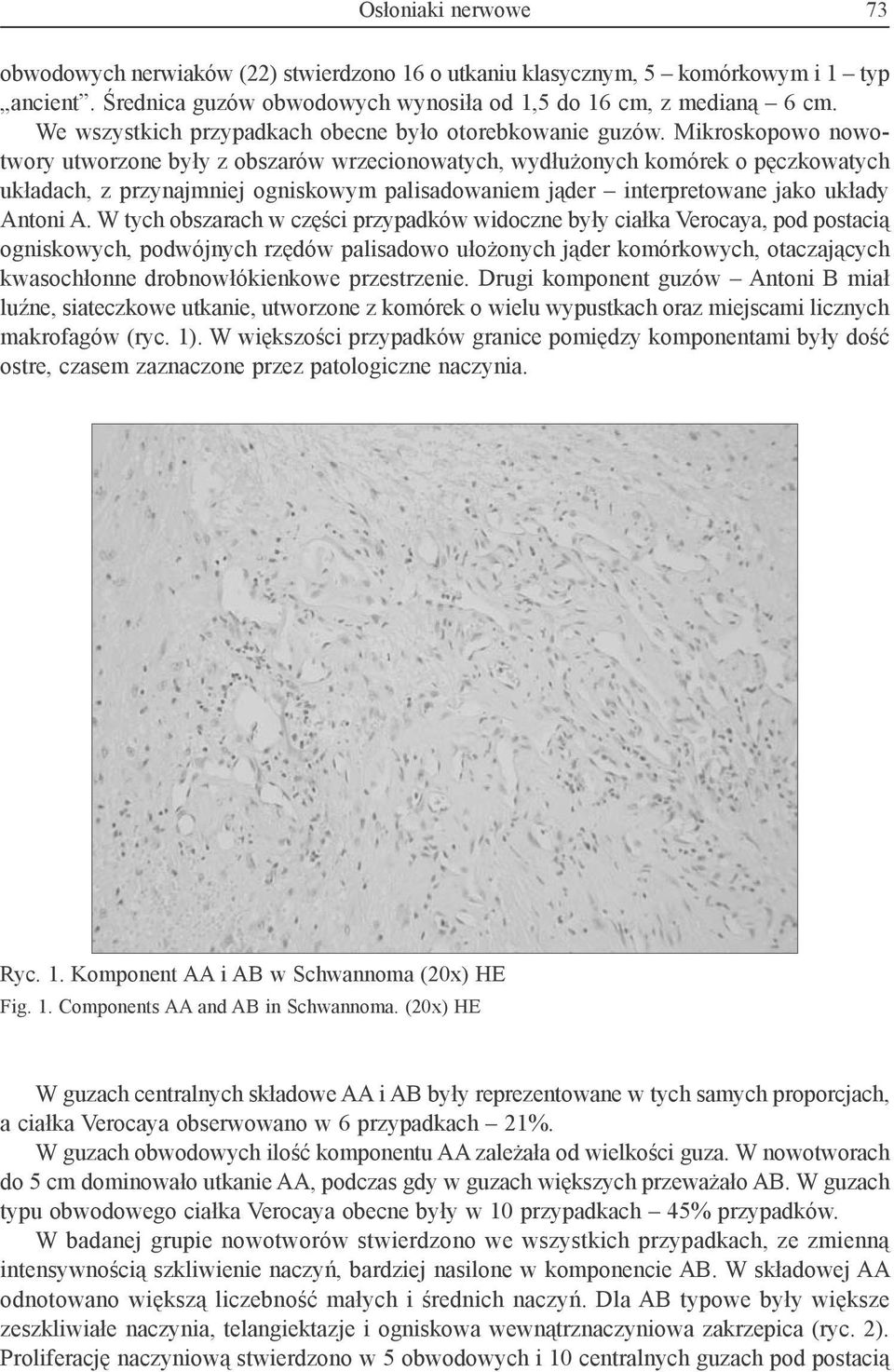 Mikroskopowo nowotwory utworzone były z obszarów wrzecionowatych, wydłużonych komórek o pęczkowatych układach, z przynajmniej ogniskowym palisadowaniem jąder interpretowane jako układy Antoni A.