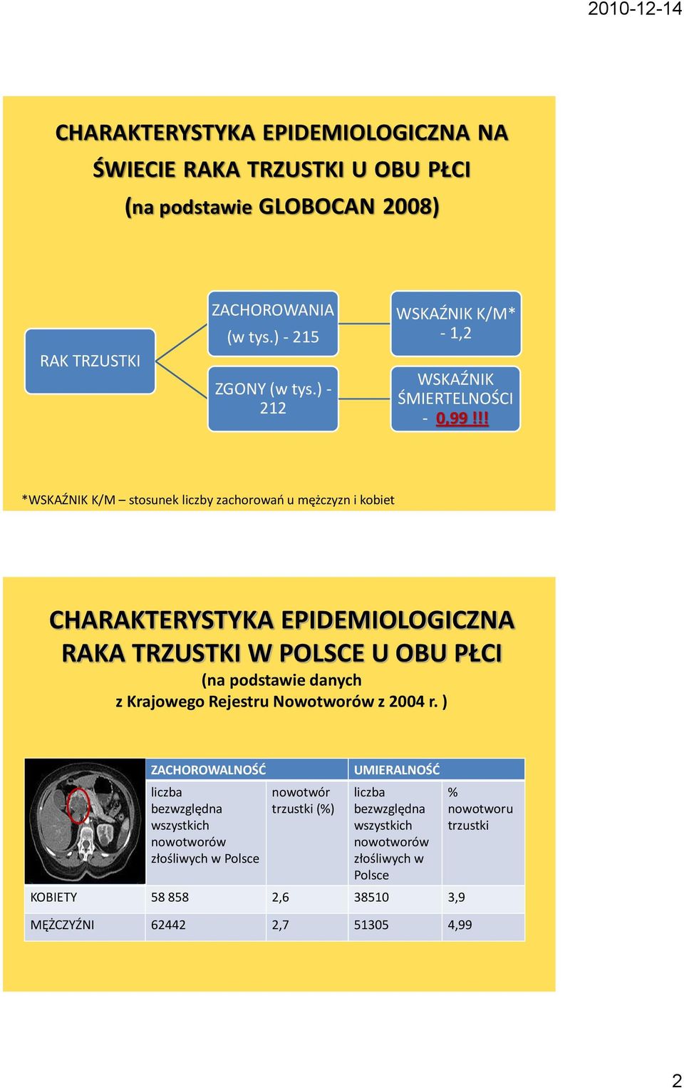 !! *WSKAŹNIK K/M stosunek liczby zachorowao u mężczyzn i kobiet CHARAKTERYSTYKA EPIDEMIOLOGICZNA RAKA TRZUSTKI W POLSCE U OBU PŁCI (na podstawie danych z Krajowego