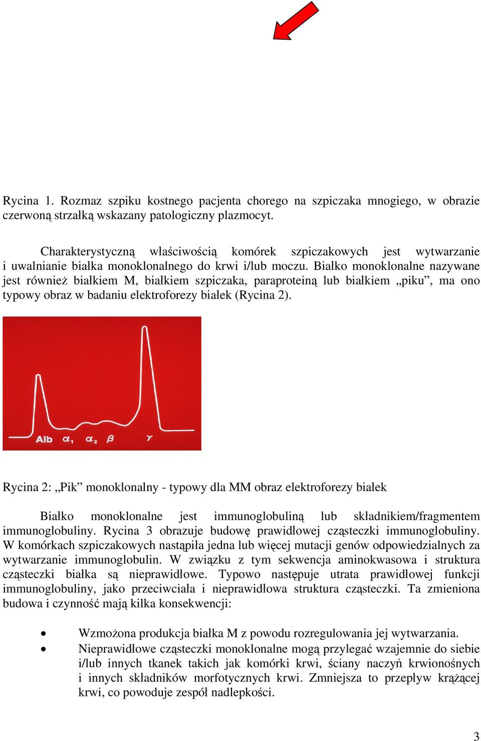 Białko monoklonalne nazywane jest również białkiem M, białkiem szpiczaka, paraproteiną lub białkiem piku, ma ono typowy obraz w badaniu elektroforezy białek (Rycina 2).