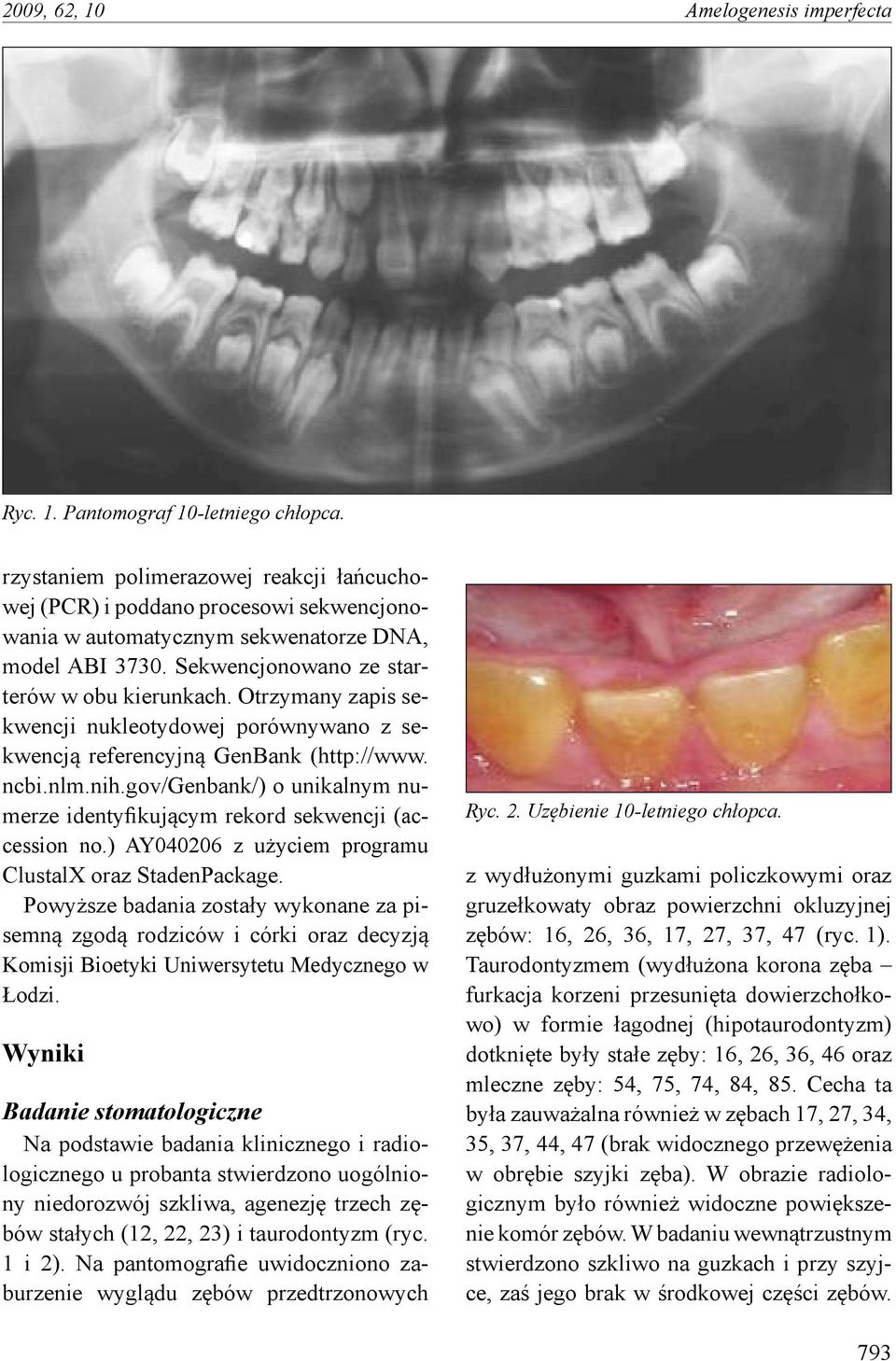 Otrzymany zapis sekwencji nukleotydowej porównywano z sekwencją referencyjną GenBank (http://www. ncbi.nlm.nih.gov/genbank/) o unikalnym numerze identyfikującym rekord sekwencji (accession no.