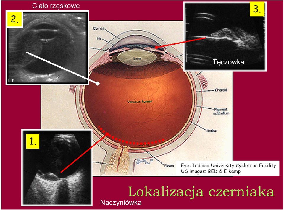 Naczyniówka