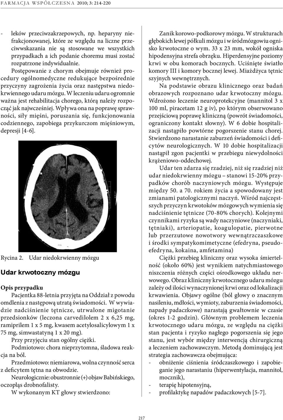 Postępowanie z chorym obejmuje również procedury ogólnomedyczne redukujące bezpośrednie przyczyny zagrożenia życia oraz następstwa niedokrwiennego udaru mózgu.