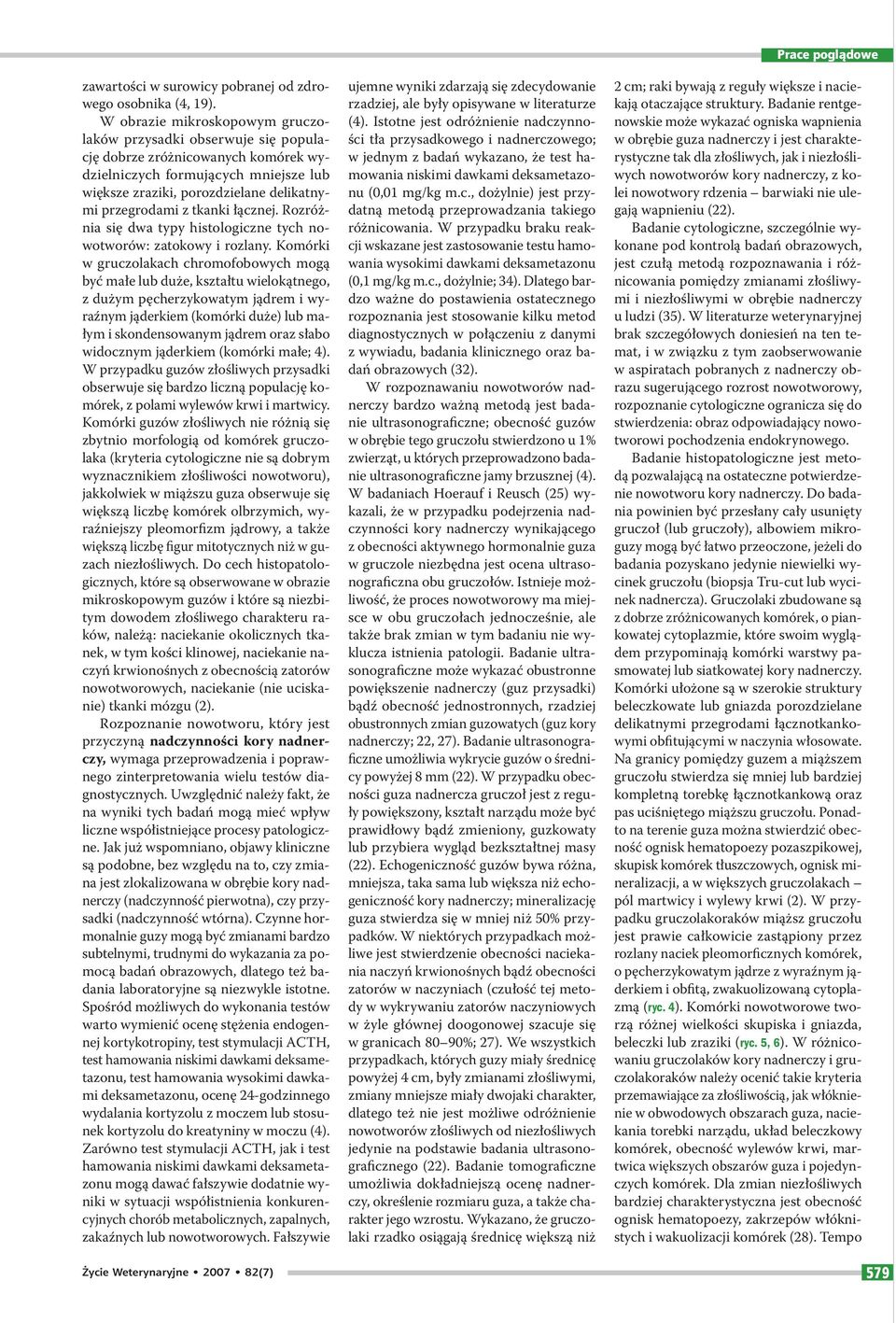 tkanki łącznej. Rozróżnia się dwa typy histologiczne tych nowotworów: zatokowy i rozlany.