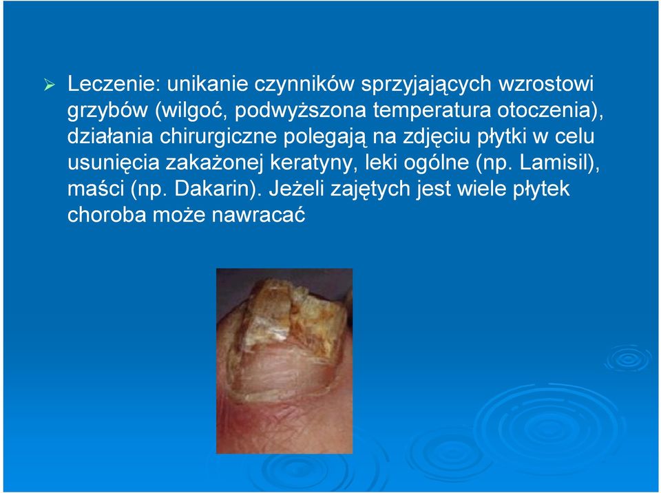 zdjęciu płytki w celu usunięcia zakażonej keratyny, leki ogólne (np.