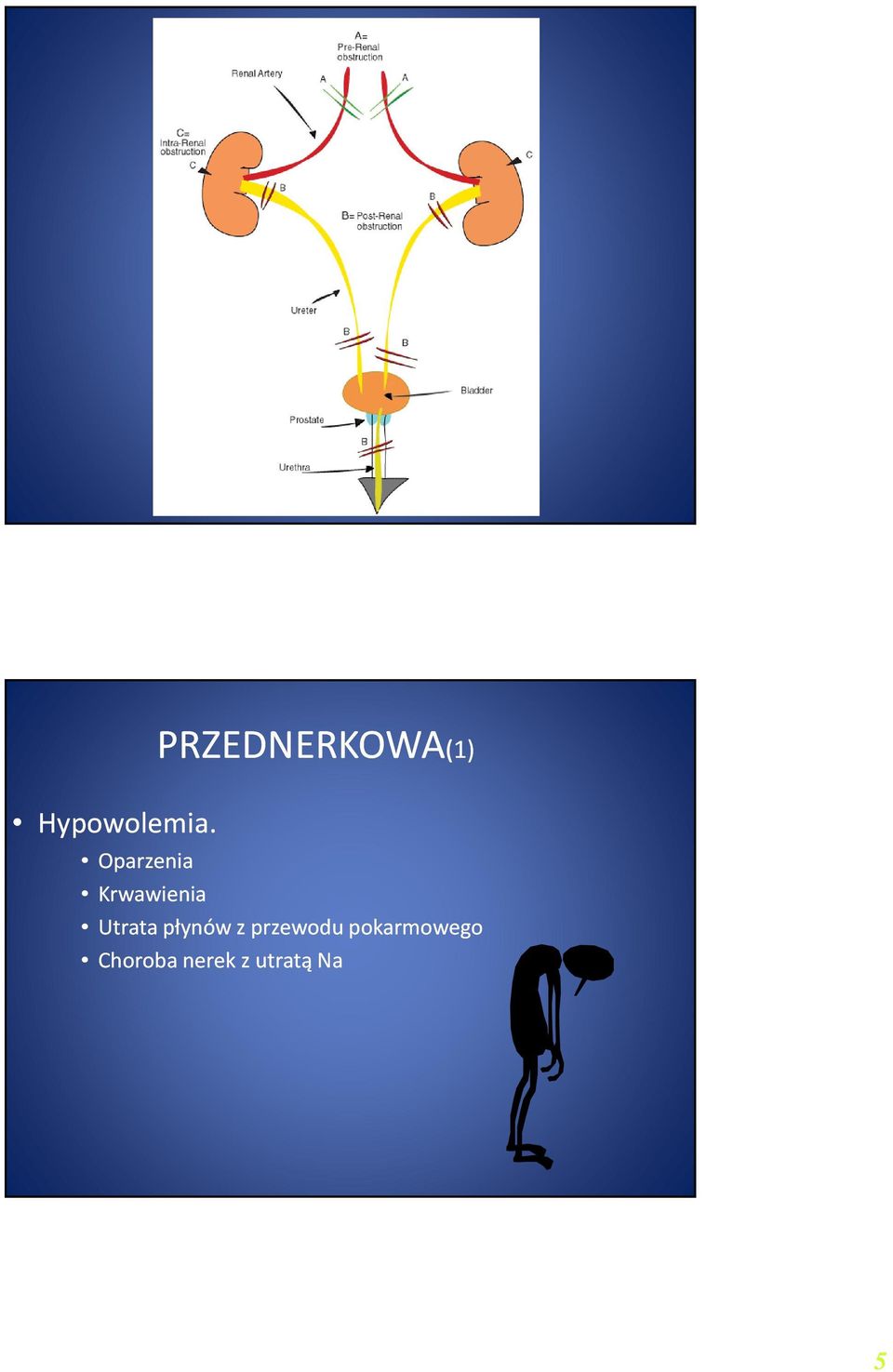 Krwawienia Utrata płynów z