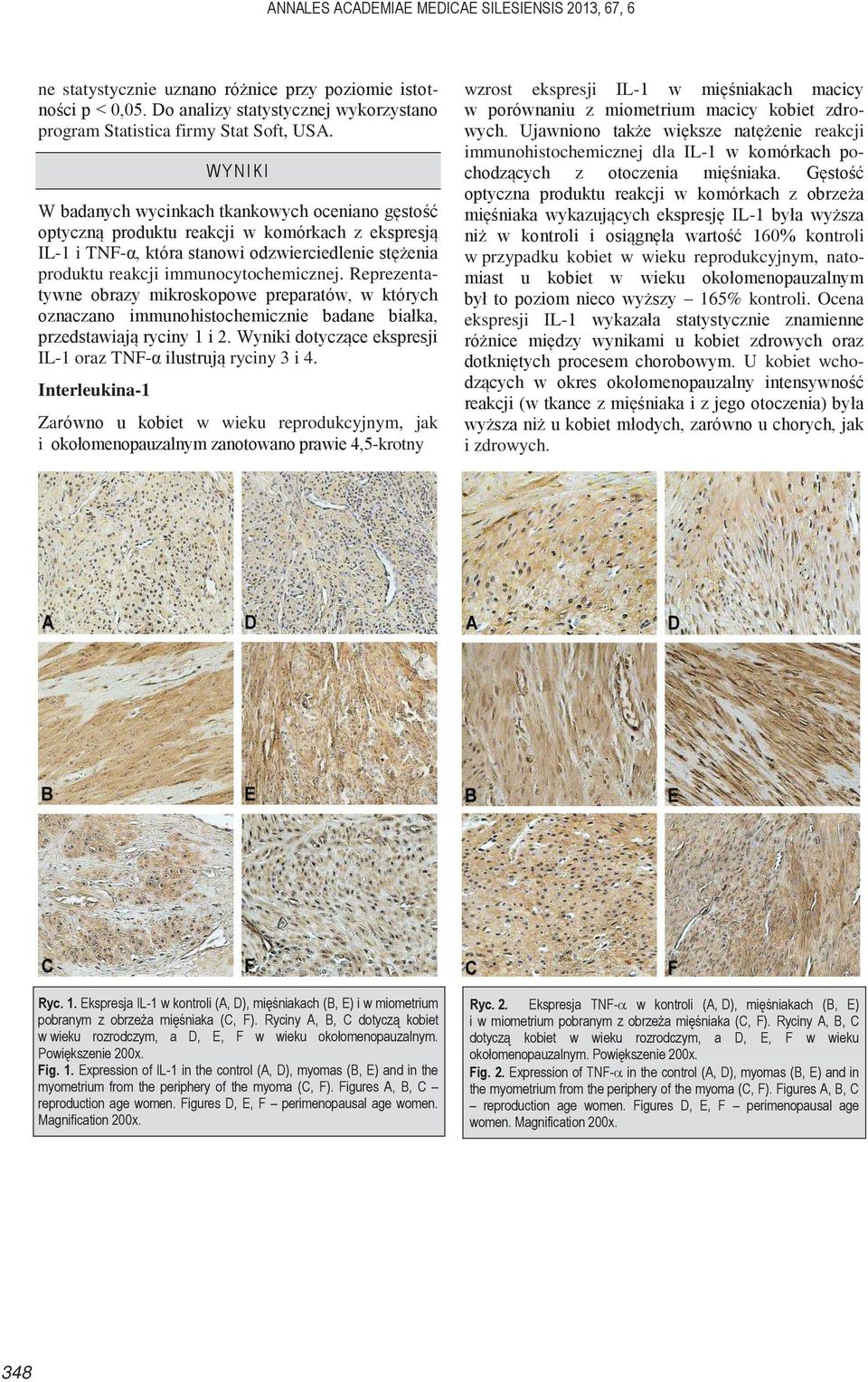 Reprezentatywne obrazy mikroskopowe preparatów, w których oznaczano immunohistochemicznie badane białka, przedstawiają ryciny 1 i 2. Wyniki dotyczące ekspresji IL-1 oraz TNF-α ilustrują ryciny 3 i 4.