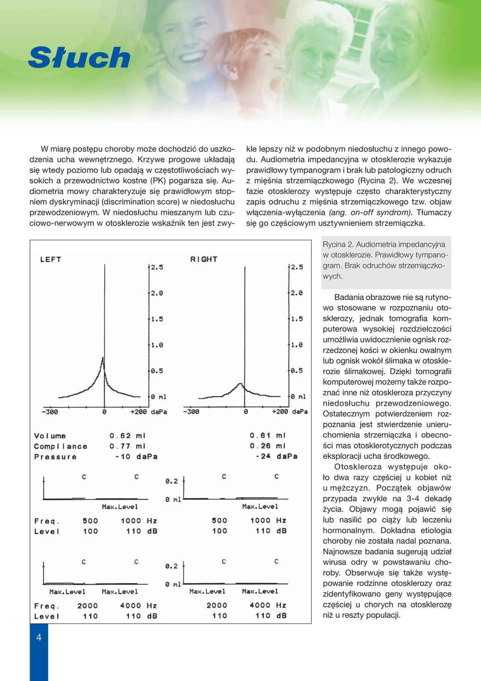 Audiometria mowy charakteryzuje się prawidłowym stopniem dyskryminacji (discrimination score) w niedosłuchu przewodzeniowym.