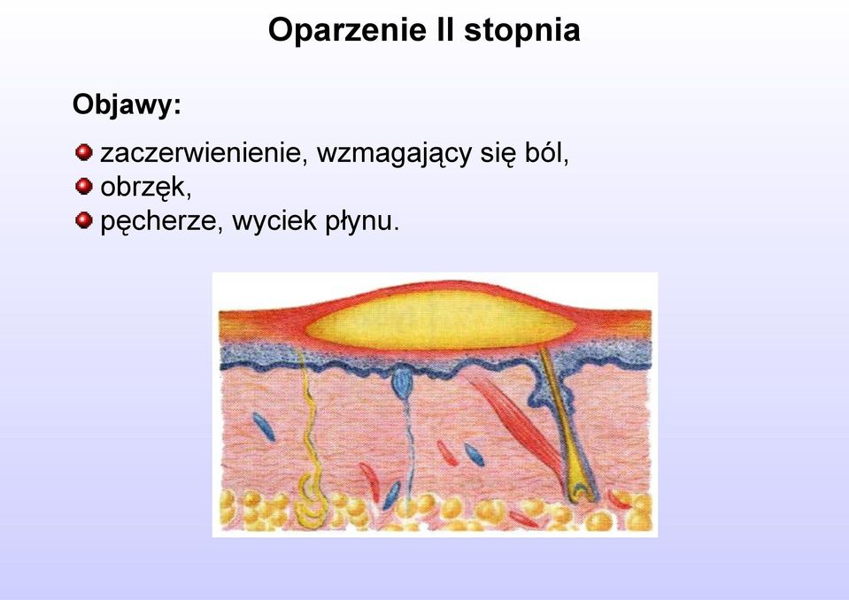 wzmagający się ból,