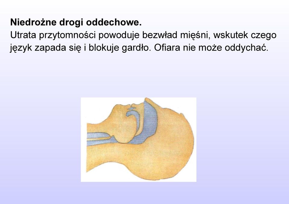 mięśni, wskutek czego język zapada