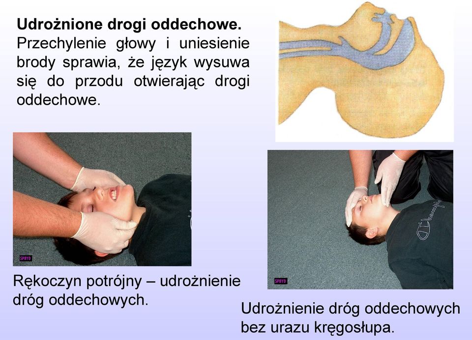 wysuwa się do przodu otwierając drogi oddechowe.