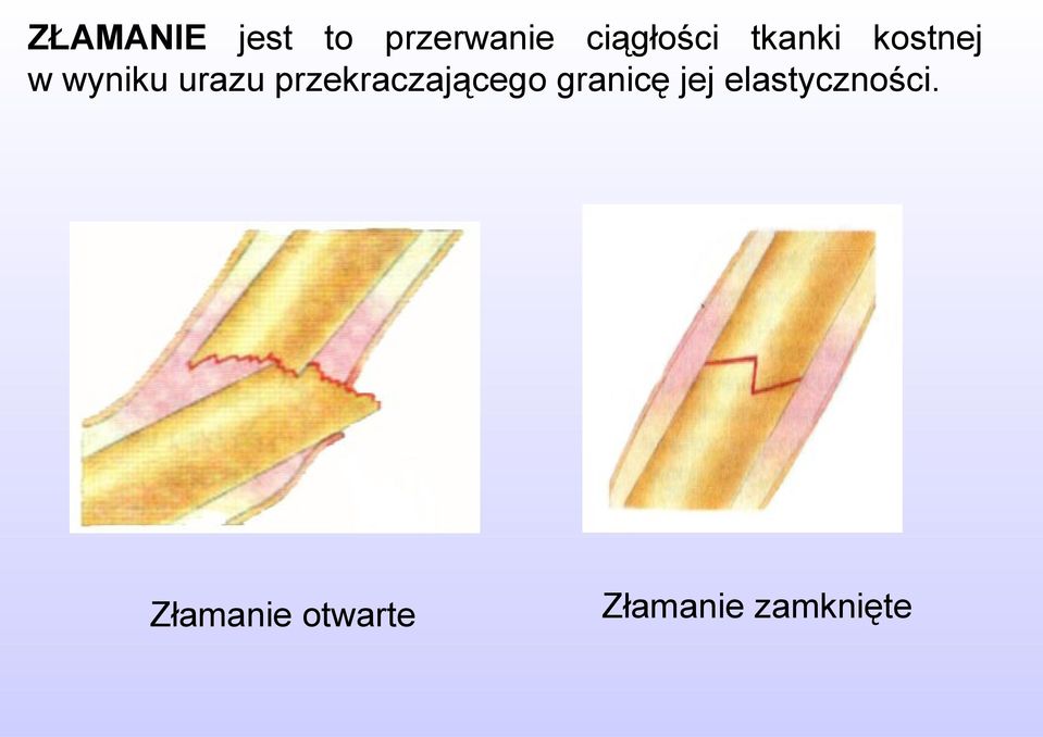 urazu przekraczającego granicę jej