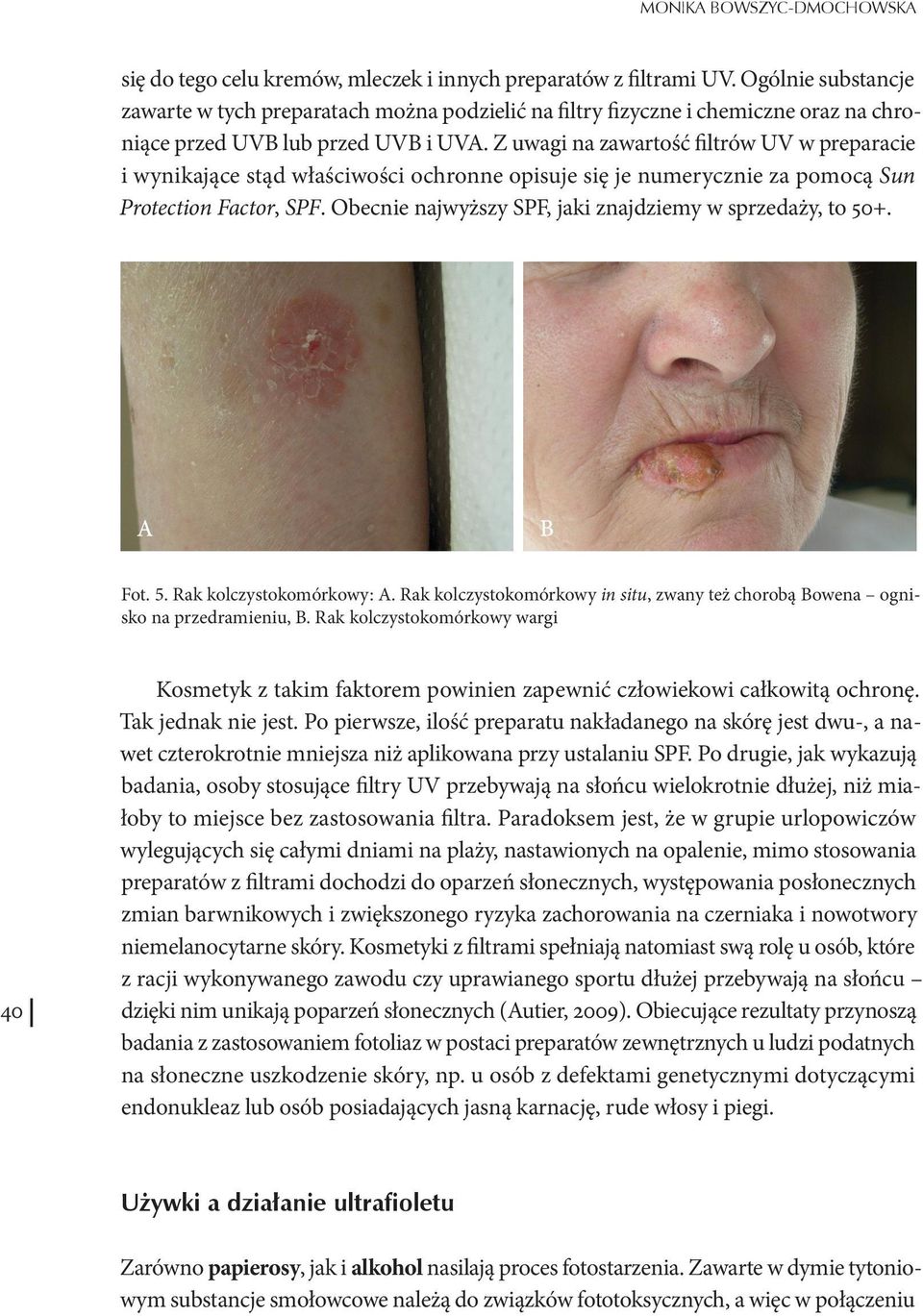 Z uwagi na zawartość filtrów UV w preparacie i wynikające stąd właściwości ochronne opisuje się je numerycznie za pomocą Sun Protection Factor, SPF.