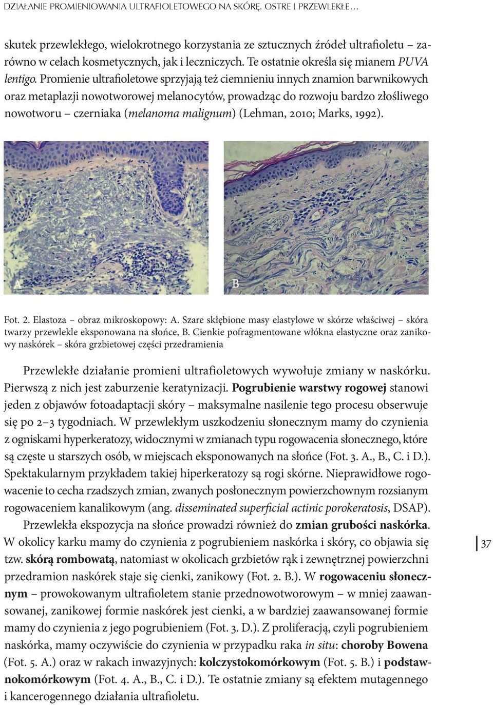 Promienie ultrafioletowe sprzyjają też ciemnieniu innych znamion barwnikowych oraz metaplazji nowotworowej melanocytów, prowadząc do rozwoju bardzo złośliwego nowotworu czerniaka (melanoma malignum)