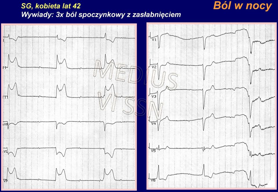 spoczynkowy z