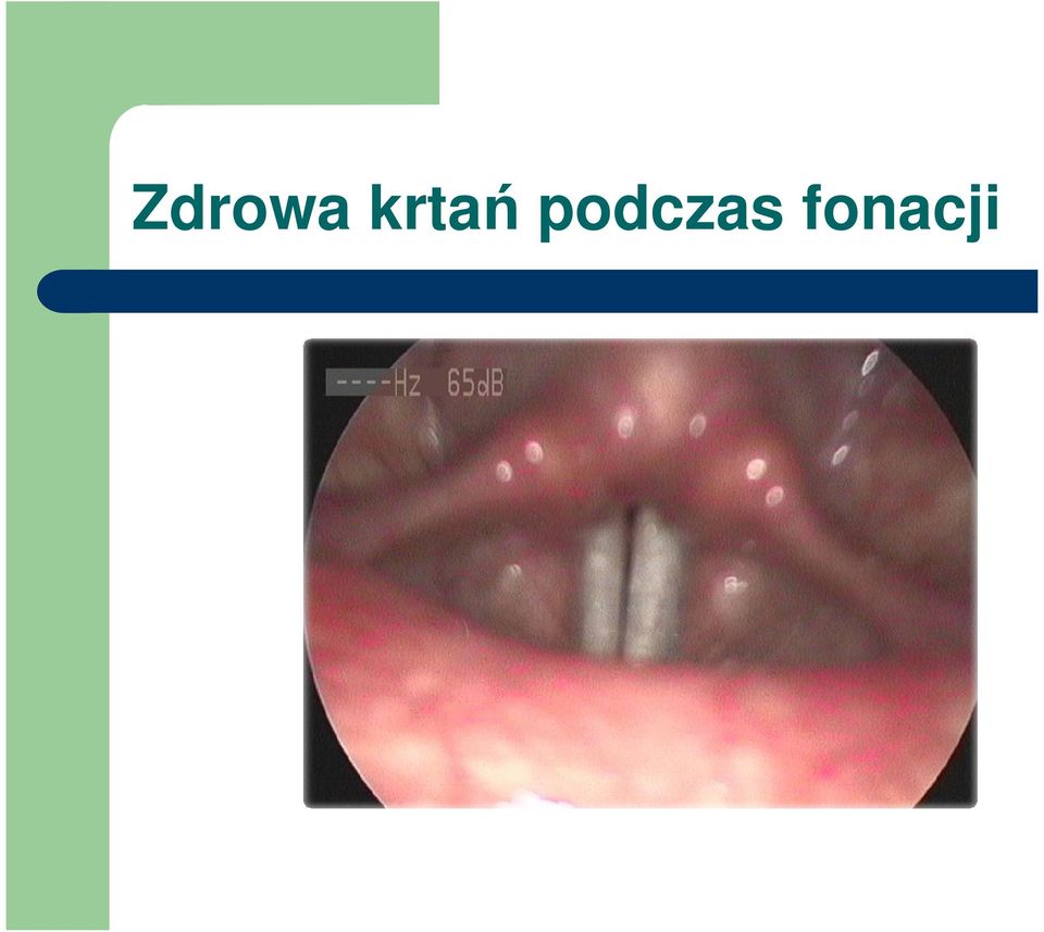 podczas
