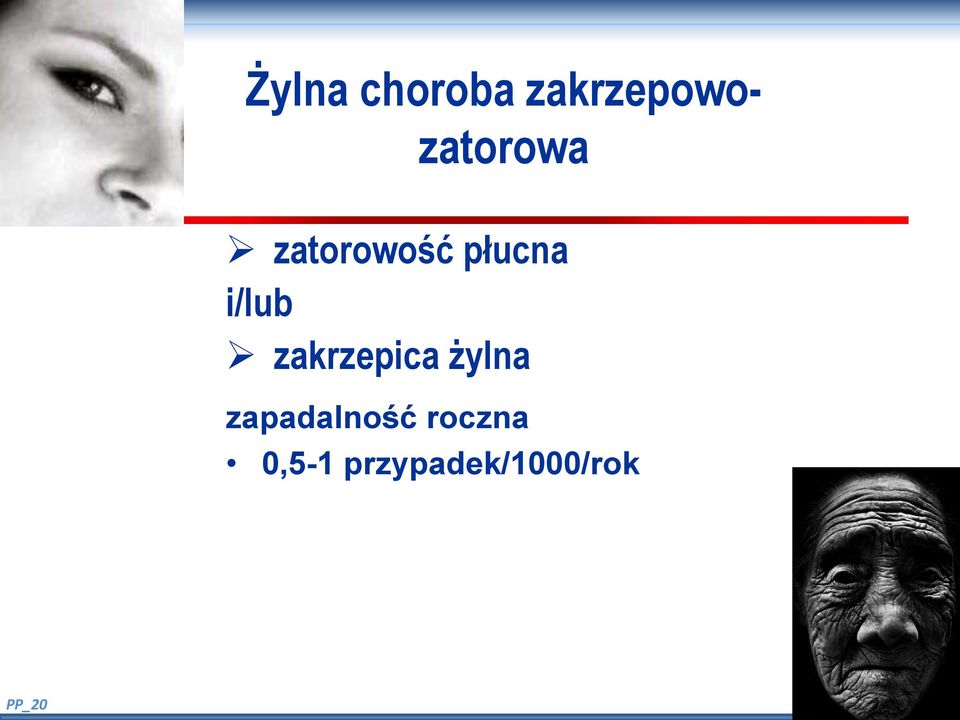 i/lub zakrzepica żylna