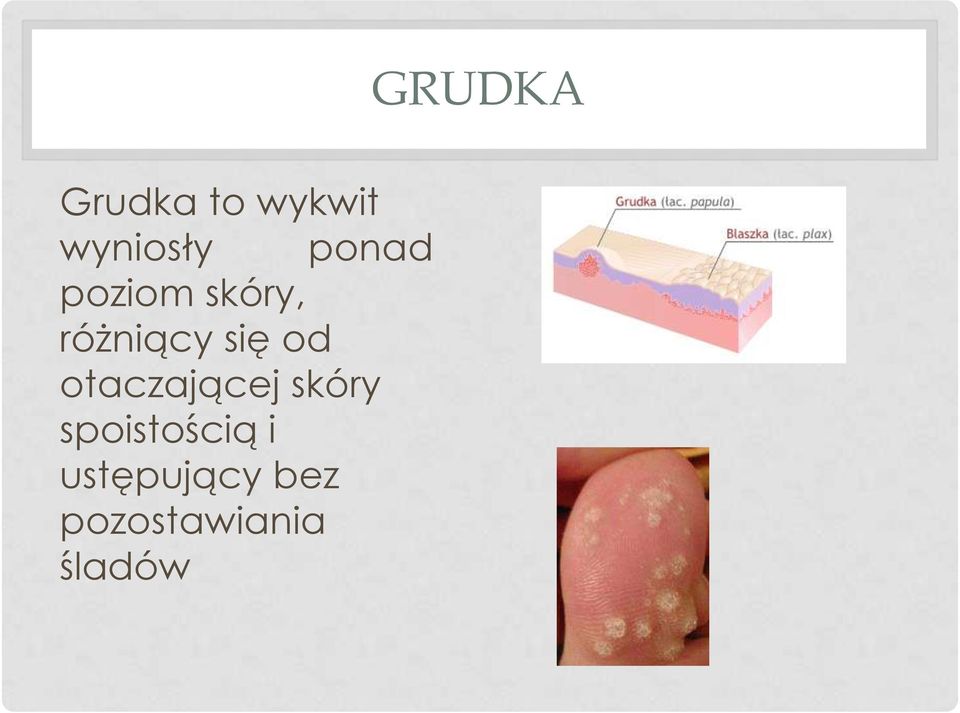 od otaczającej skóry spoistością