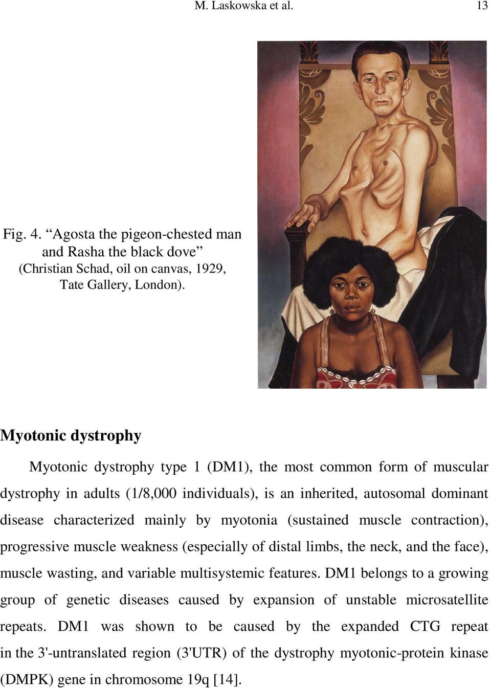 myotonia (sustained muscle contraction), progressive muscle weakness (especially of distal limbs, the neck, and the face), muscle wasting, and variable multisystemic features.
