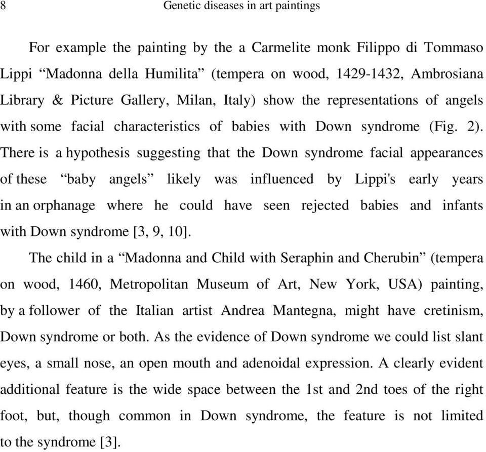 There is a hypothesis suggesting that the Down syndrome facial appearances of these baby angels likely was influenced by Lippi's early years in an orphanage where he could have seen rejected babies