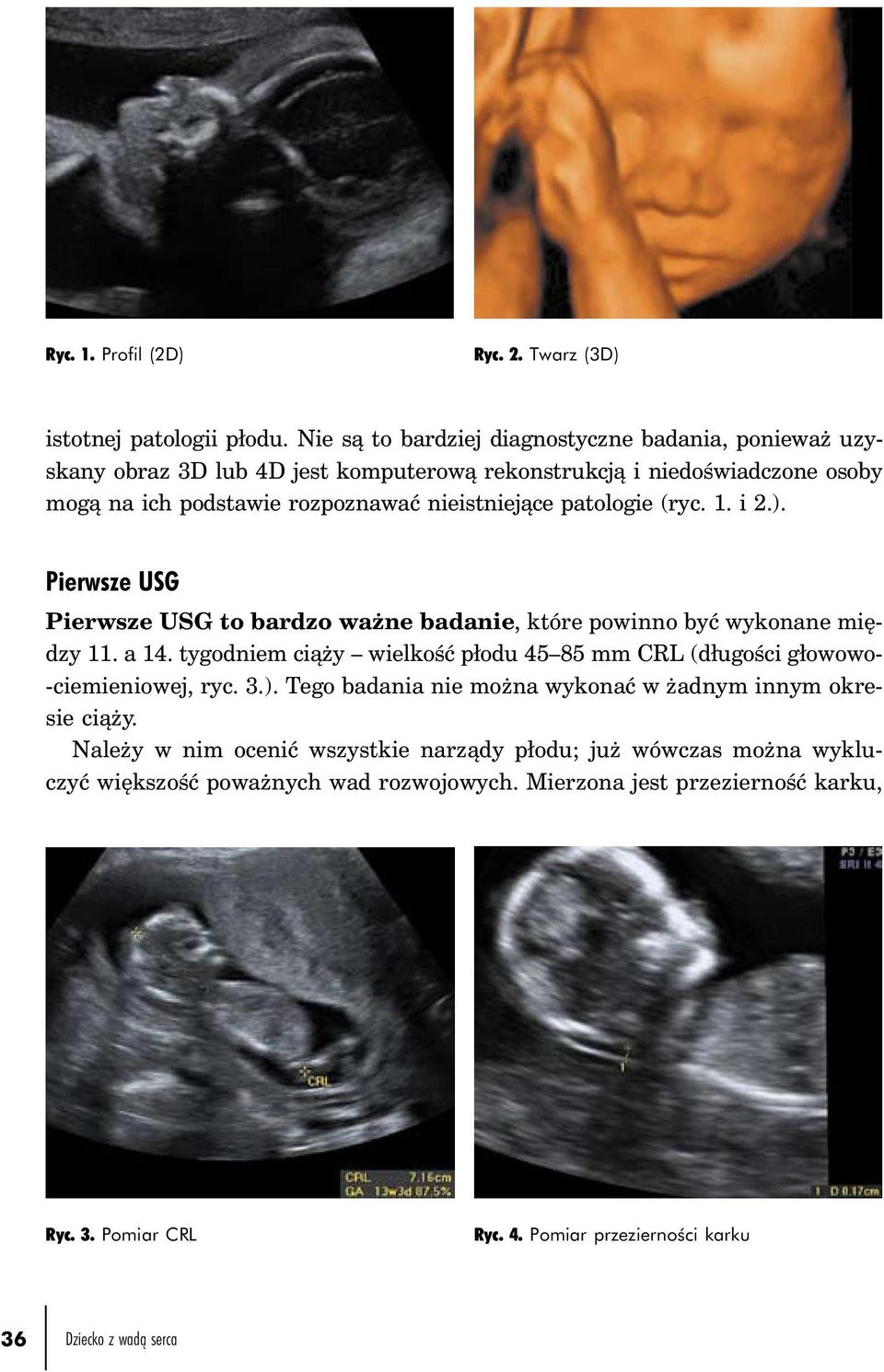 patologie (ryc. 1. i 2.). Pierwsze USG Pierwsze USG to bardzo ważne badanie, które powinno być wykonane między 11. a 14.