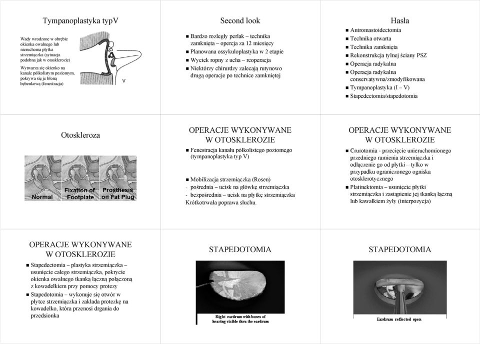 zalecają rutynowo drugą operacje po technice zamkniętej Hasła Antromastoidectomia Technika otwarta Technika zamknięta Rekonstrukcja tylnej ściany PSZ Operacja radykalna Operacja radykalna