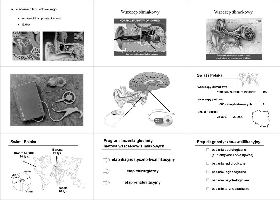 Program leczenia głuchoty metodą wszczepów ślimakowych etap diagnostyczno-kwalifikacyjny Etap diagnostyczno-kwalifikacyjny badania audiologiczne (subiektywne