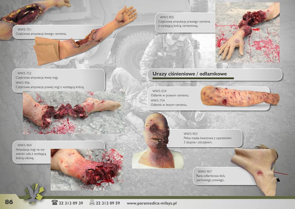 WW3-054 Odłamki w prawym ramieniu. WW3-754 Odłamki w lewym ramieniu. WW3-903 Pełna maska twarzowa z oparzeniem 3 stopnia i obrzękiem.