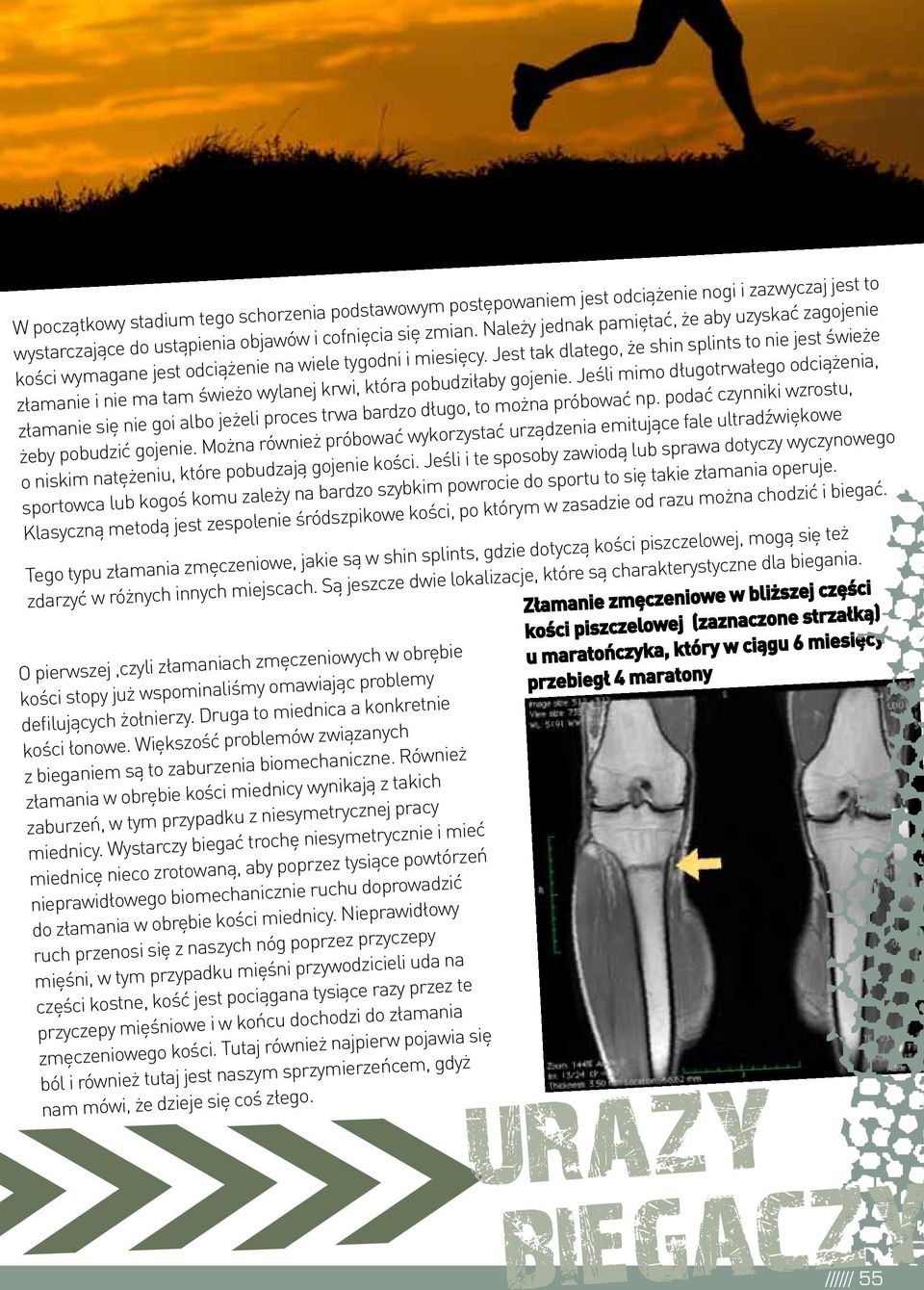 Jest tak dlatego, że shin splints to nie jest świeże złamanie i nie ma tam świeżo wylanej krwi, która pobudziłaby gojenie.