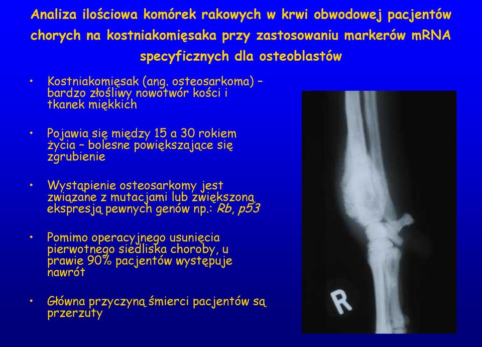 osteosarkoma) bardzo złośliwy nowotwór kości i tkanek miękkich Pojawia się między 15 a 30 rokiem życia bolesne powiększające się zgrubienie