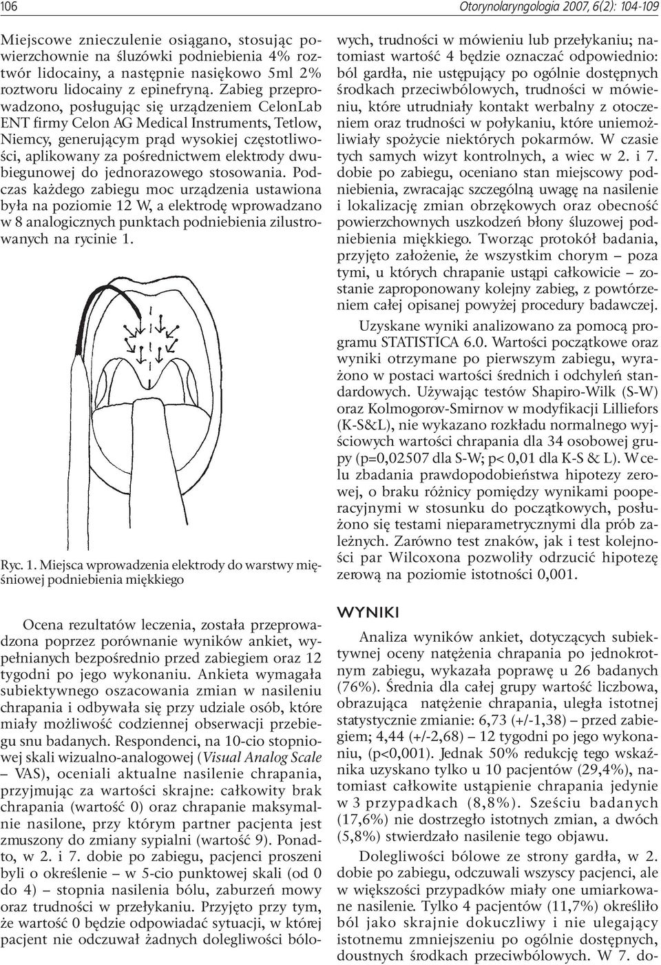 Zabieg przeprowadzono, pos³uguj¹c siê urz¹dzeniem CelonLab ENT firmy Celon AG Medical Instruments, Tetlow, Niemcy, generuj¹cym pr¹d wysokiej czêstotliwoœci, aplikowany za poœrednictwem elektrody