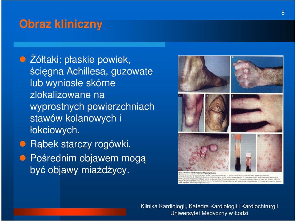 wyprostnych powierzchniach stawów kolanowych i łokciowych.