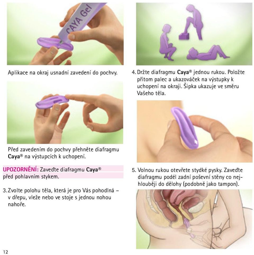 Před zavedením do pochvy přehněte diafragmu Caya na výstupcích k uchopení. UPOZORNĚNÍ: Zaveďte diafragmu Caya před pohlavním stykem. 3.