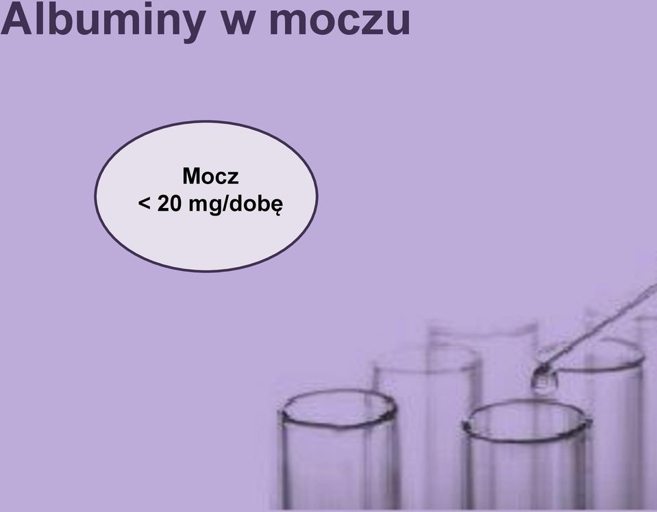 Mocz < 20