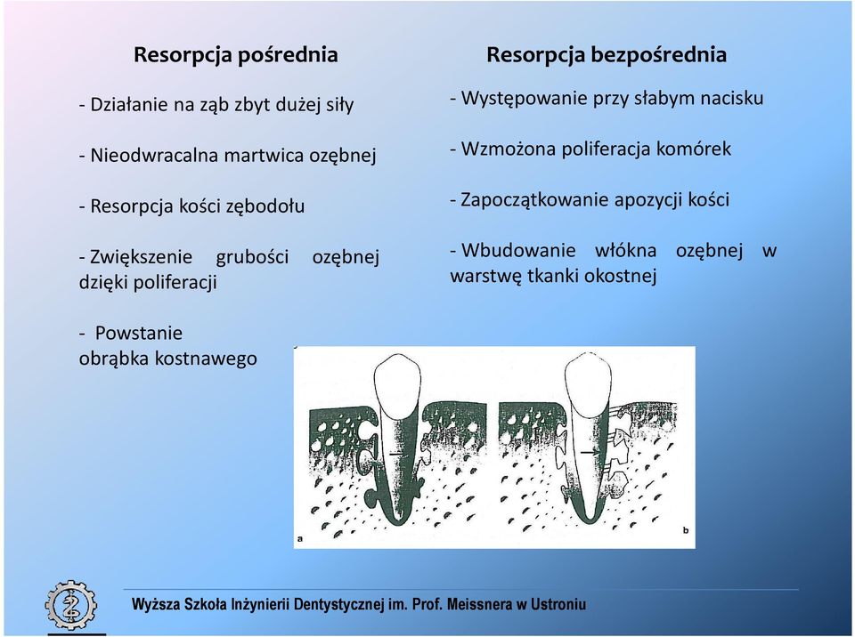 bezpośrednia - Występowanie przy słabym nacisku - Wzmożona poliferacja komórek -