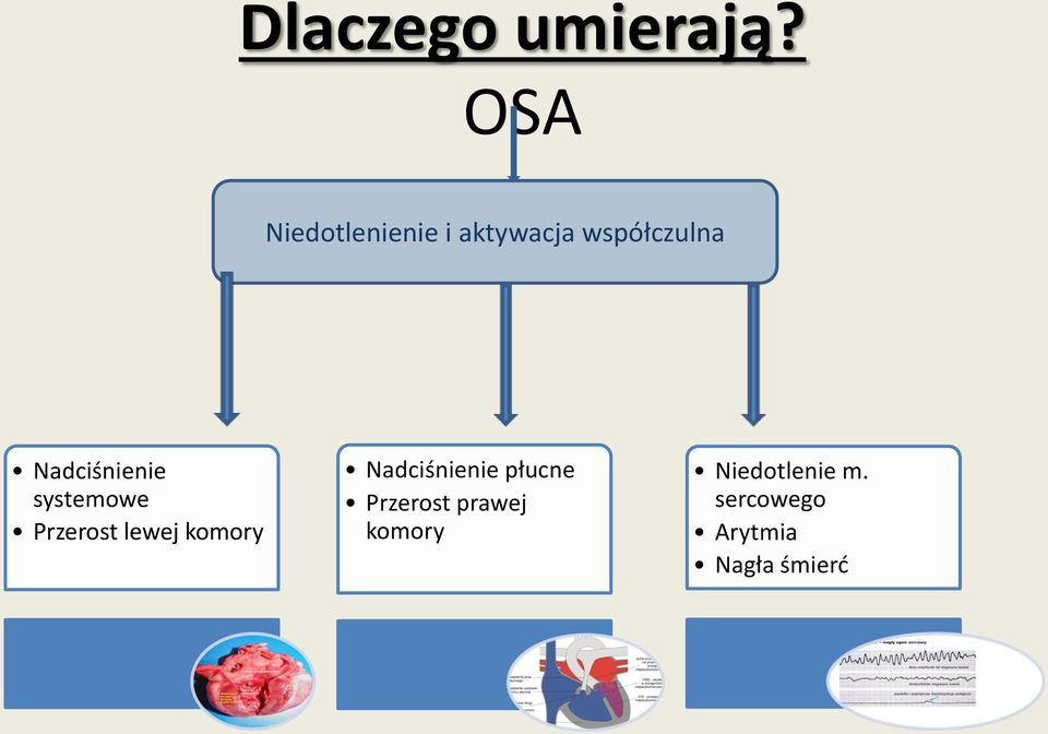 Nadciśnienie systemowe Przerost lewej komory