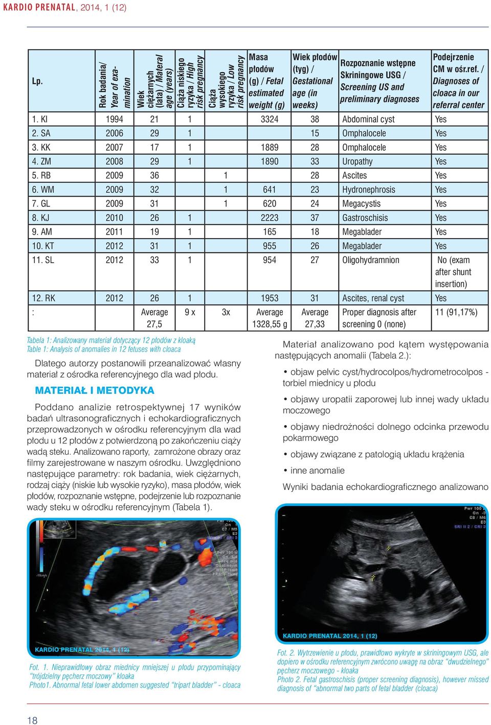 weight (g) Wiek płodów (tyg) / Gestational age (in weeks) Rozpoznanie wstępne Skriningowe USG / Screening US and preliminary diagnoses 1. KI 1994 21 1 3324 38 Abdominal cyst Yes 2.