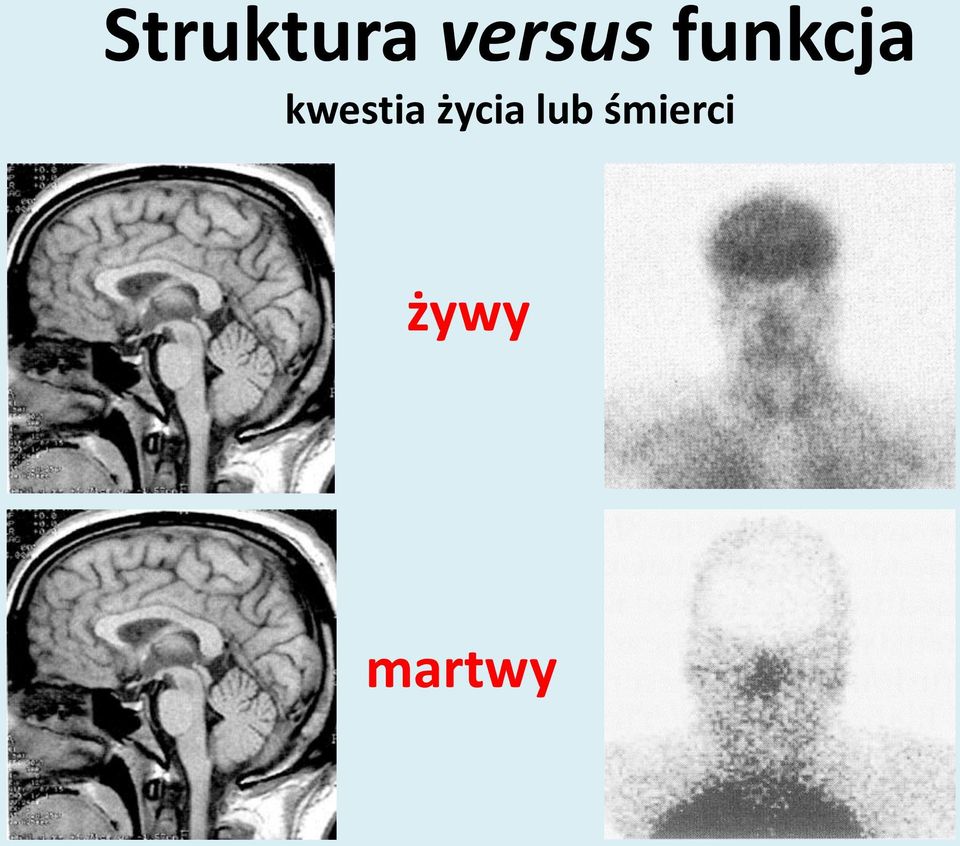 kwestia życia