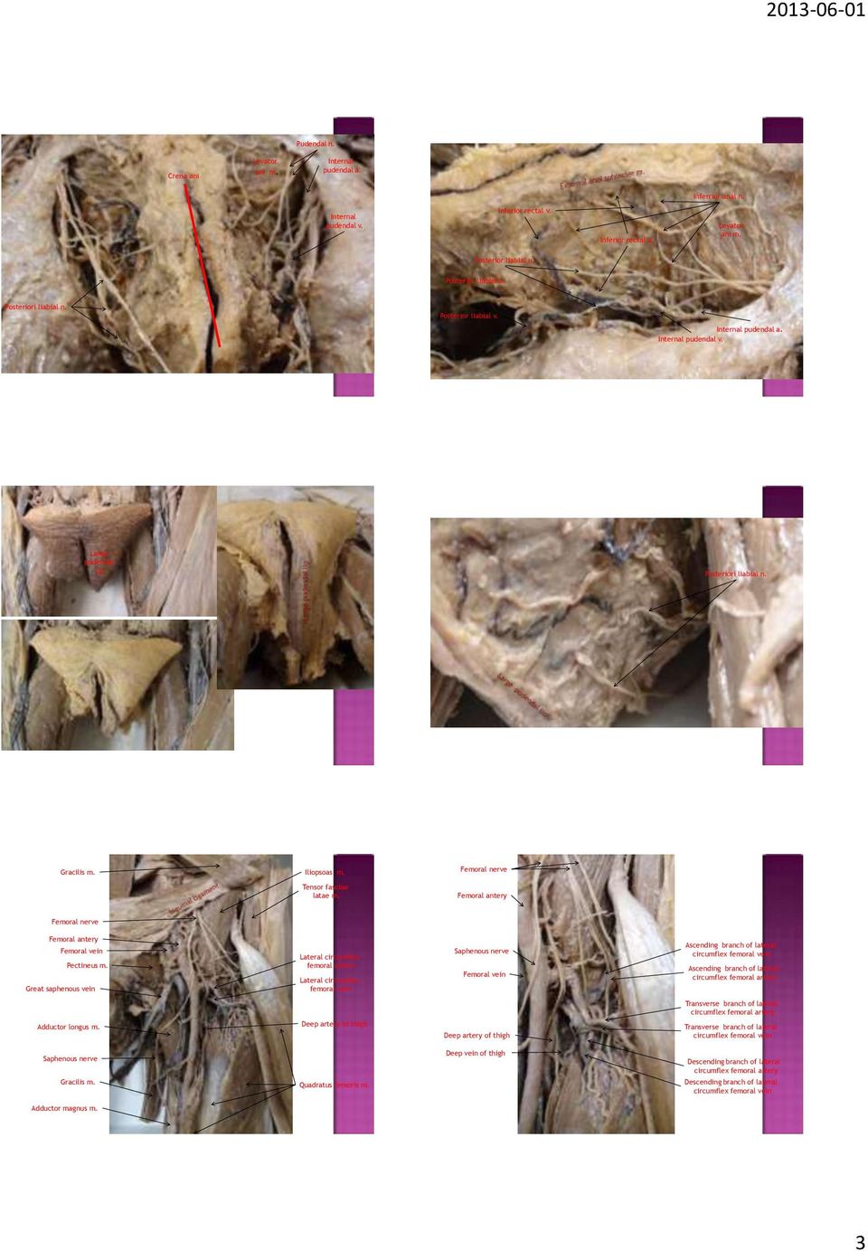 Femoral Femoral antery Femoral Femoral antery Femoral vein Pectineus m.
