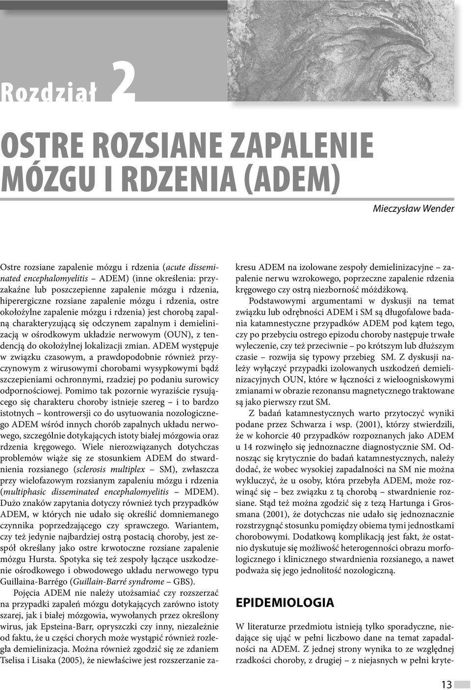 demielinizacją w ośrodkowym układzie nerwowym (OUN), z tendencją do okołożylnej lokalizacji zmian.