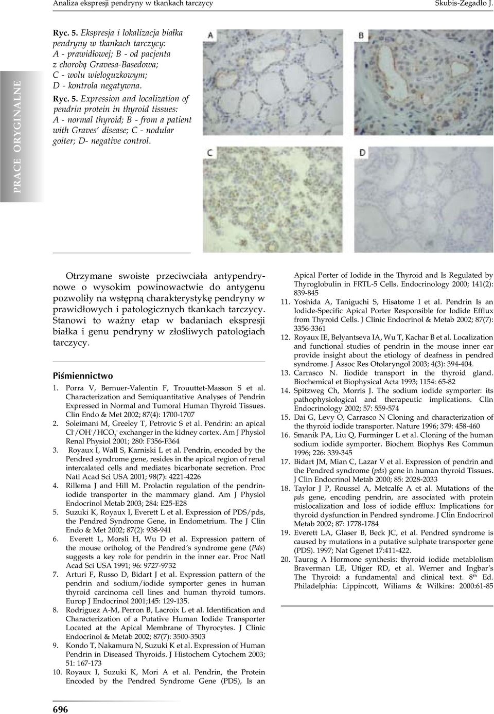 Expression and localization of pendrin protein in thyroid tissues: A - normal thyroid; B - from a patient with Graves disease; C - nodular goiter; D- negative control.