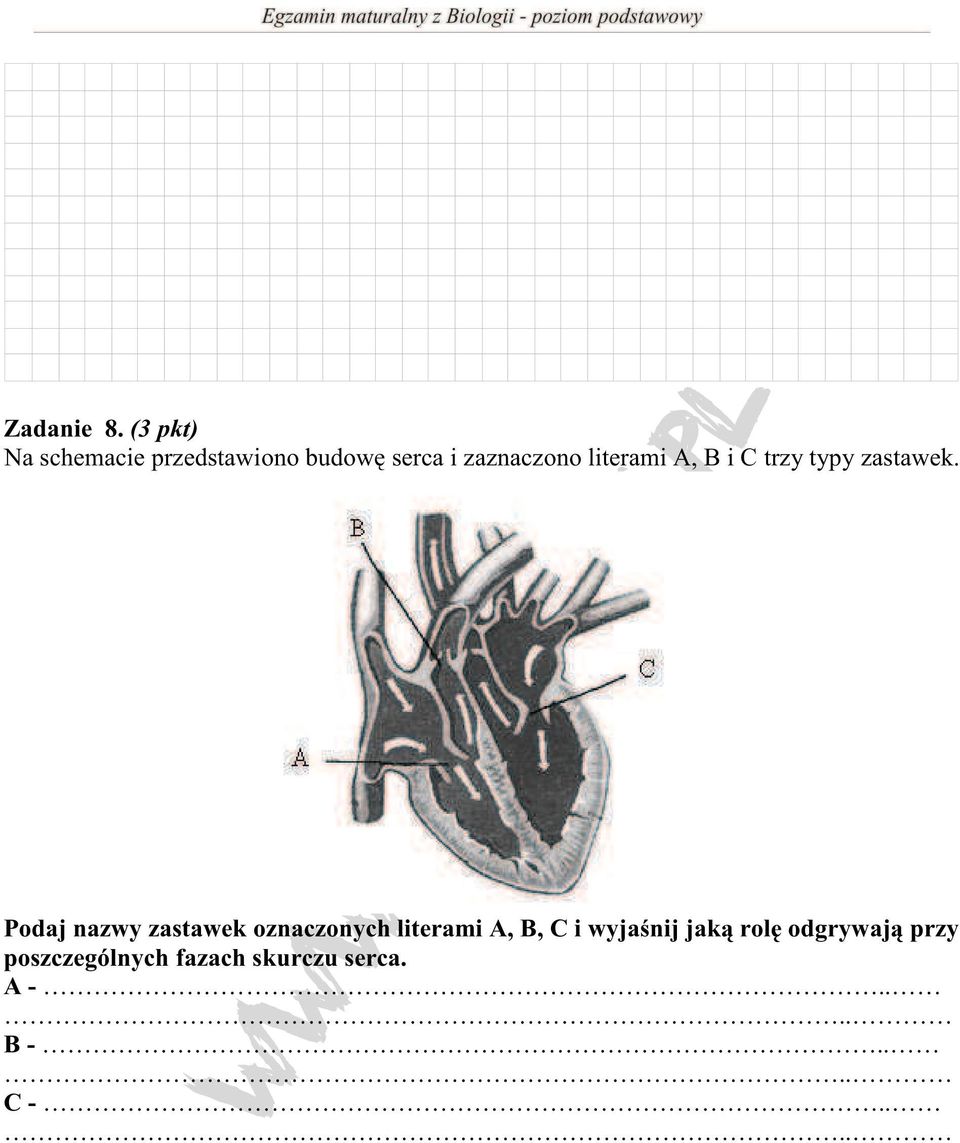 literami A, B i C trzy typy zastawek.