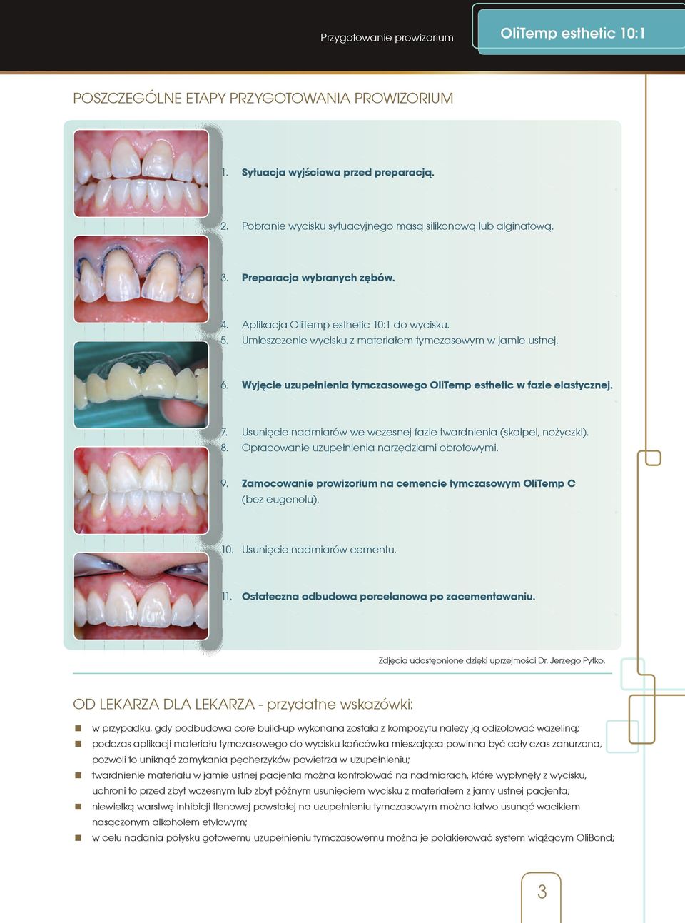 Wyjęcie uzupełnienia tymczasowego OliTemp esthetic w fazie elastycznej. 7. Usunięcie nadmiarów we wczesnej fazie twardnienia (skalpel, nożyczki). 8. Opracowanie uzupełnienia narzędziami obrotowymi. 9.