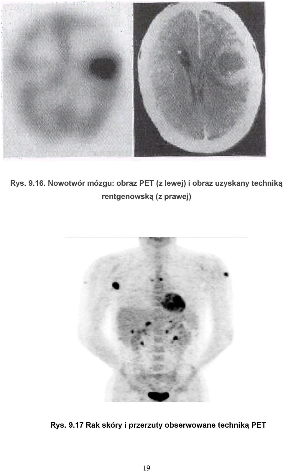 obraz uzyskany techniką rentgenowską