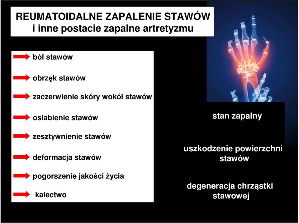 zesztywnienie stawów deformacja stawów pogorszenie jakości życia