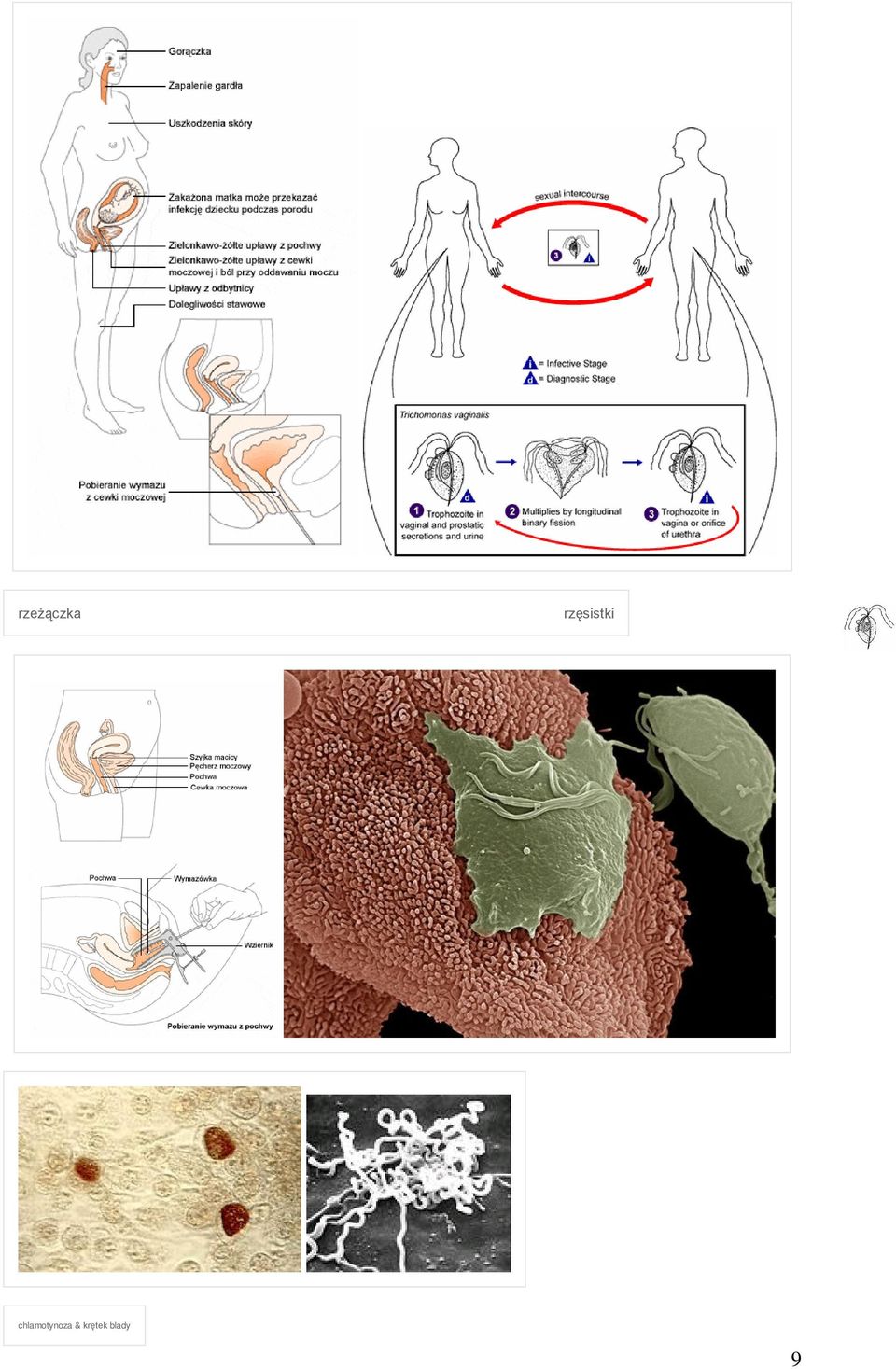 chlamotynoza